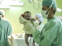 Neugeborenes Baby in den Händen eines Spitalsarztes